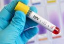 Preocupación por el crecimiento del diagnóstico tardío de VIH