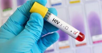 Preocupación por el crecimiento del diagnóstico tardío de VIH