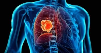 Qué son los nódulos pulmonares, la lesión por la que será operado el papa León XIV
